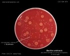 bacillus anthracis